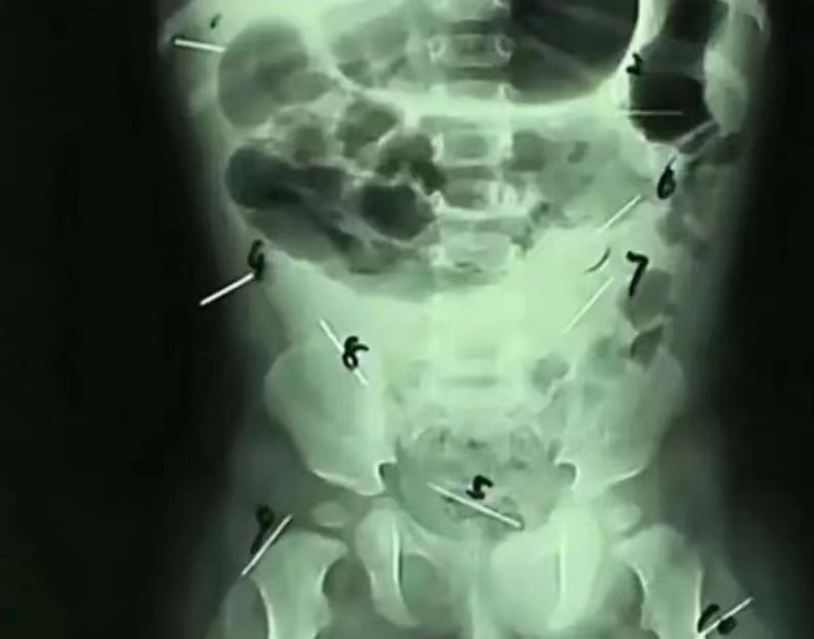 爱游戏娱乐 -煡n@羵Ctz脉鯁 